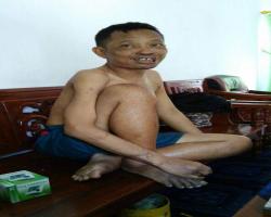 Sesungguhnya Dia Fakir Di Dalam Kekaya